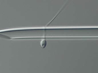 DIC shape, size and number of vacuoles in the sperm head.jpg
