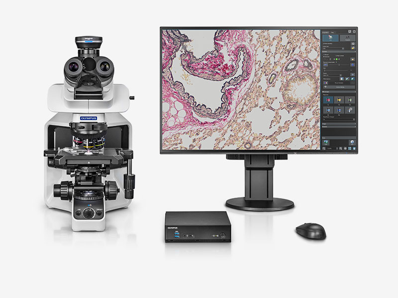 [5631012] Microscope camera, Olympus DP23 w. DP2-AOU Stand-Alone Unit, 6.4 MPx, 1/1.8", Color